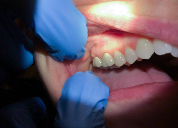 Best Urgent Tooth Repair  in Lake Camelot, IL